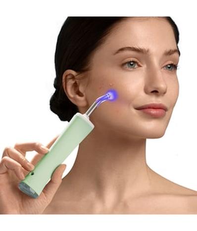 Foreo ESPADA 2 Plus, sinivalolaite aknen hoitoon – kuva 2/6