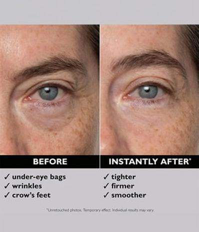 Peter Thomas Roth Instant FIRMxÂ® Eye Silmänympärysgeeli 15 ml