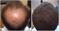 thumb93319247