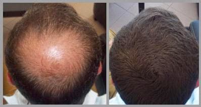 Toppik Large Dark Brown