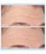 thumb93458300