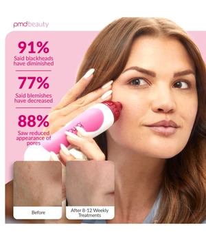PMD Personal Microderm Pink Mikrodermabrasio 1 kpl