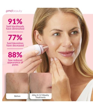 PMD Personal Microderm Pro Blush Mikrodermabrasio 1 kpl