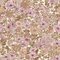 Ilse Pink - 1114401-01 Tapetti – kuva 1