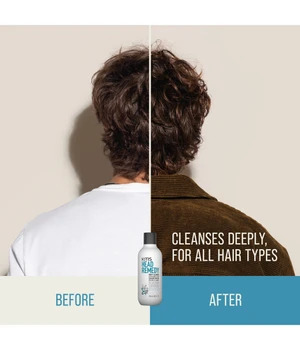 KMS Headremedy START Deep Cleanse Shampoo 300 ml
