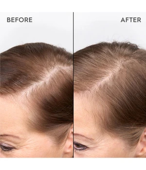 Kerasilk SPECIALISTS Redensifying Scalp Serum 100 ml