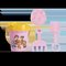 Moxy - Paw Patrol: Beach Bucket, 5 Pcs - Pink (160025) – kuva 1