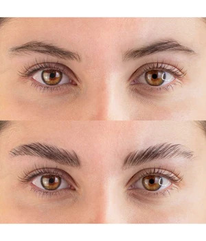 Fleeky Browlift Kit