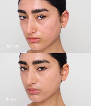 Kess Berlin Concealer Stick SPF 20 Refill Peitevoide 3 g Medium 2