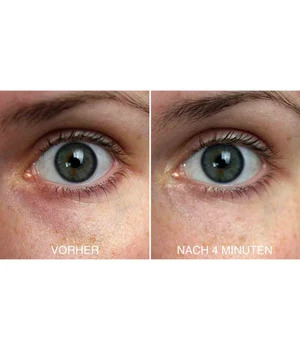 VITAYES Perfector Silmäseerumi 15 ml