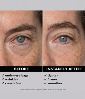 Peter Thomas Roth Instant FIRMxÂ® Eye Silmänympärysgeeli 15 ml